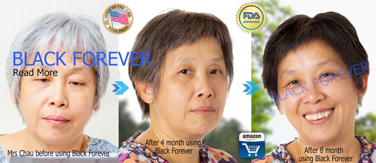 Black Forever Antigray - Best Formula for Hair Loss and Grey Hair Treament