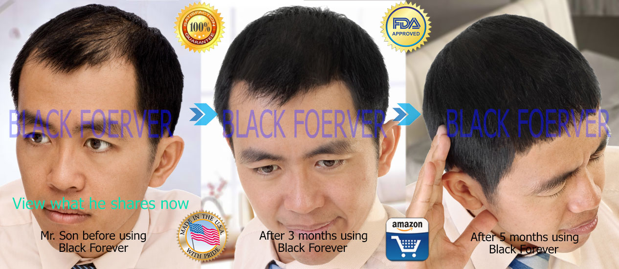 Black Forever Antigray - Best Formula for Hair Loss and Grey Hair Treament